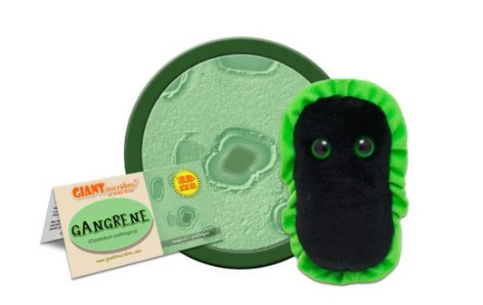 Gangrene (Clostridium Perfringens)