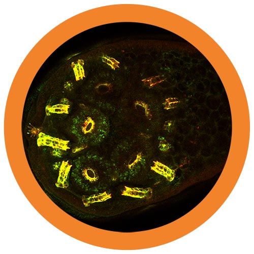Antibody (Immunoglobulin)
