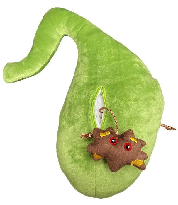 Deluxe Gallbladder with Gallstones