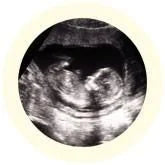Fetus