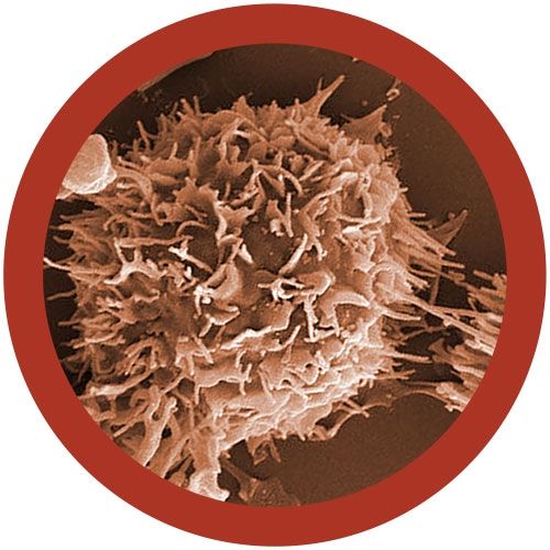 Kidney Cancer