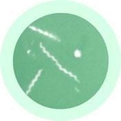 Lyme Disease (Borrelia Burgdorferi)