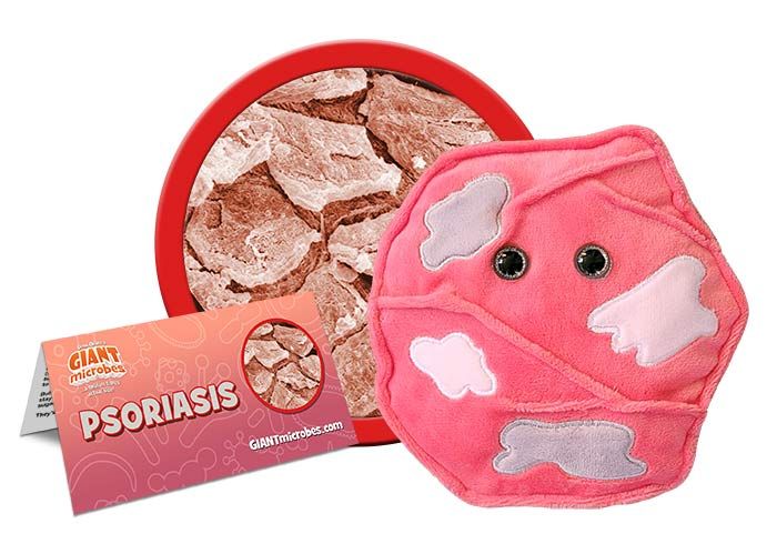Psoriasis