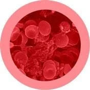 Gigantic Red Blood Cell