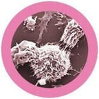 Breast Cancer (Malignant neoplasm)