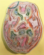 Bipolar Embroidered Patches