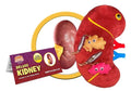 Deluxe Kidney with Kidney Stones