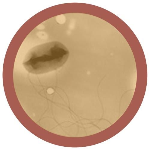 E. coli (Escherichia coli)