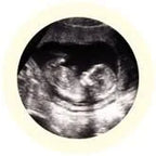 Fetus