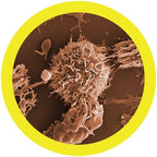 Leukemia
