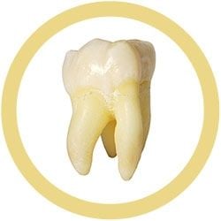 Tooth (Molar)