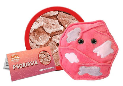 Psoriasis