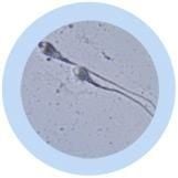 Sperm Cell Key Chain